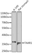 Western blot analysis of various lysates using TAAR1 Rabbit polyclonal antibody (STJ118606) at 1:1000 dilution. Secondary antibody: HRP Goat Anti-Rabbit IgG (H+L) (STJS000856) at 1:10000 dilution. Lysates/proteins: 25 Mu g per lane. Blocking buffer: 3% nonfat dry milk in TBST. Detection: ECL Basic Kit. Exposure time: 6min.