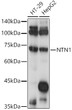 Western blot analysis of extracts of various cell lines, using NTN1 antibody (STJ118675) at 1:1000 dilution. Secondary antibody: HRP Goat Anti-Rabbit IgG (H+L) (STJS000856) at 1:10000 dilution. Lysates/proteins: 25 Mu g per lane. Blocking buffer: 3% nonfat dry milk in TBST. Detection: ECL Basic Kit. Exposure time: 1s.