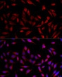 Immunofluorescence analysis of HeLa cells using ACSL1 rabbit polyclonal antibody (STJ118692) at dilution of 1:200 (40x lens). Blue: DAPI for nuclear staining.