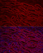 Immunofluorescence analysis of rat kidney using ACSL1 rabbit polyclonal antibody (STJ118692) at dilution of 1:200 (40x lens). Blue: DAPI for nuclear staining.