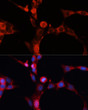 Immunofluorescence analysis of NIH-3T3 cells using SMPD1/ ASM Polyclonal Antibody (STJ118698) at dilution of 1:100 (40x lens). Blue: DAPI for nuclear staining.