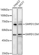 Western blot analysis of extracts of various cell lines, using SMPD1/ ASM antibody (STJ118698) at 1:500 dilution. Secondary antibody: HRP Goat Anti-Rabbit IgG (H+L) (STJS000856) at 1:10000 dilution. Lysates/proteins: 25 Mu g per lane. Blocking buffer: 3% nonfat dry milk in TBST. Detection: ECL Basic Kit. Exposure time: 5s.