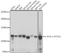 Western blot analysis of various lysates using Alpha-Actinin-4 Rabbit polyclonal antibody (STJ118740) at 1:1000 dilution. Secondary antibody: HRP Goat Anti-Rabbit IgG (H+L) (STJS000856) at 1:10000 dilution. Lysates/proteins: 25 Mu g per lane. Blocking buffer: 3% nonfat dry milk in TBST. Detection: ECL Basic Kit. Exposure time: 1s.