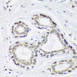 Immunohistochemistry analysis of SUN2 in paraffin-embedded Human breast using SUN2 Rabbit polyclonal antibody (STJ118755) at dilution of 1:100 (40x lens). Perform microwave antigen retrieval with 10 mM Tris/EDTA buffer pH 9. 0 before commencing with immunohistochemistry staining protocol.