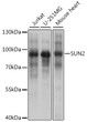 Western blot analysis of various lysates using SUN2 Rabbit polyclonal antibody (STJ118755) at 1:1000 dilution. Secondary antibody: HRP Goat Anti-Rabbit IgG (H+L) (STJS000856) at 1:10000 dilution. Lysates/proteins: 25 Mu g per lane. Blocking buffer: 3% nonfat dry milk in TBST. Detection: ECL Basic Kit. Exposure time: 5s.