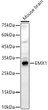 Western blot analysis of lysates from Mouse brain, using EMX1 Rabbit polyclonal antibody (STJ118798) at 1:800 dilution. Secondary antibody: HRP Goat Anti-Rabbit IgG (H+L) (STJS000856) at 1:10000 dilution. Lysates/proteins: 25ug per lane. Blocking buffer: 3% nonfat dry milk in TBST. Detection: ECL Basic Kit. Exposure time: 60s. Western blot analysis of lysates from Mouse brain, using EMX1 Rabbit polyclonal antibody (STJ118798) at 1:800 dilution. Secondary antibody: HRP Goat Anti-Rabbit IgG (H+L) (STJS000856) at 1:10000 dilution. Lysates/proteins: 25ug per lane. Blocking buffer: 3% nonfat dry milk in TBST. Detection: ECL Basic Kit. Exposure time: 60s.