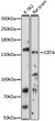 Western blot analysis of various lysates using CIITA Rabbit polyclonal antibody (STJ118829) at 1:1000 dilution. Secondary antibody: HRP Goat Anti-Rabbit IgG (H+L) (STJS000856) at 1:10000 dilution. Lysates/proteins: 25 Mu g per lane. Blocking buffer: 3% nonfat dry milk in TBST. Detection: ECL Basic Kit. Exposure time: 5s.