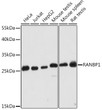 Western blot analysis of various lysates using RANBP1 Rabbit polyclonal antibody (STJ118850) at 1:2000 dilution. Secondary antibody: HRP Goat Anti-Rabbit IgG (H+L) (STJS000856) at 1:10000 dilution. Lysates/proteins: 25 Mu g per lane. Blocking buffer: 3% nonfat dry milk in TBST. Detection: ECL Basic Kit. Exposure time: 30s.