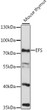 Western blot analysis of lysates from mouse thymus, using EFS Rabbit polyclonal antibody (STJ118907) at 1:1000 dilution. Secondary antibody: HRP Goat Anti-Rabbit IgG (H+L) (STJS000856) at 1:10000 dilution. Lysates/proteins: 25 Mu g per lane. Blocking buffer: 3% nonfat dry milk in TBST. Detection: ECL Basic Kit. Exposure time: 90s.