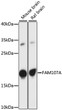 Western blot analysis of various lysates using FAM107A Rabbit polyclonal antibody (STJ118920) at 1:1000 dilution. Secondary antibody: HRP Goat Anti-Rabbit IgG (H+L) (STJS000856) at 1:10000 dilution. Lysates/proteins: 25 Mu g per lane. Blocking buffer: 3% nonfat dry milk in TBST. Detection: ECL Basic Kit. Exposure time: 90s.
