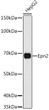 Western blot analysis of lysates from HepG2 cells, using Epn2 Rabbit polyclonal antibody (STJ119050) at 1:1000 dilution. Secondary antibody: HRP Goat Anti-Rabbit IgG (H+L) (STJS000856) at 1:10000 dilution. Lysates/proteins: 25 Mu g per lane. Blocking buffer: 3% nonfat dry milk in TBST. Detection: ECL Basic Kit. Exposure time: 90s.