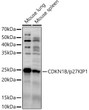 Western blot analysis of extracts of various cell lines, using CDKN1B/p27KIP1 antibody (STJ119057) at 1:900 dilution. Secondary antibody: HRP Goat Anti-Rabbit IgG (H+L) (STJS000856) at 1:10000 dilution. Lysates/proteins: 25 Mu g per lane. Blocking buffer: 3% nonfat dry milk in TBST. Detection: ECL Basic Kit. Exposure time: 20s.