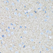 Immunohistochemistry analysis of paraffin-embedded mouse brain using ATP1B2 antibody (STJ119173) at dilution of 1:100 (40x lens). Perform microwave antigen retrieval with 10 mM PBS buffer pH 7. 2 before commencing with immunohistochemistry staining protocol.