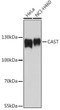 Western blot analysis of various lysates using CAST Rabbit polyclonal antibody (STJ119179) at 1:1000 dilution. Secondary antibody: HRP Goat Anti-Rabbit IgG (H+L) (STJS000856) at 1:10000 dilution. Lysates/proteins: 25 Mu g per lane. Blocking buffer: 3% nonfat dry milk in TBST. Detection: ECL Basic Kit. Exposure time: 90s.