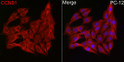 Immunofluorescence analysis of PC-12 cells using [KO Validated] Cyclin B1 Rabbit polyclonal antibody (STJ119184) at dilution of 1:100 (40x lens). Secondary antibody: Cy3 Goat Anti-Rabbit IgG (H+L) at 1:500 dilution. Blue: DAPI for nuclear staining.