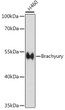Western blot analysis of extracts from H460 cells, using Brachyury Rabbit polyclonal antibody (STJ119216) at 1:1000 dilution. Secondary antibody: HRP Goat Anti-Rabbit IgG (H+L) (STJS000856) at 1:10000 dilution. Lysates/proteins: 25 Mu g per lane. Blocking buffer: 3% nonfat dry milk in TBST. Detection: ECL Basic Kit. Exposure time: 30s.