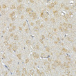 Immunohistochemistry analysis of IRS1 in paraffin-embedded rat brain tissue using IRS1 Rabbit polyclonal antibody (STJ119225) at a dilution of 1:100 (40x lens). High pressure antigen retrieval was performed with 0. 01 M citrate buffer (pH 6. 0) prior to immunohistochemistry staining.