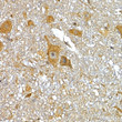 Immunohistochemistry analysis of IRS1 in paraffin-embedded mouse spinal cord tissue using IRS1 Rabbit polyclonal antibody (STJ119225) at a dilution of 1:100 (40x lens). High pressure antigen retrieval was performed with 0. 01 M citrate buffer (pH 6. 0) prior to immunohistochemistry staining.