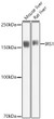 Western blot analysis of various lysates using IRS1 Rabbit polyclonal antibody (STJ119225) at 1:1000 dilution. Secondary antibody: HRP Goat Anti-Rabbit IgG (H+L) (STJS000856) at 1:10000 dilution. Lysates/ proteins: 25 Mu g per lane. Blocking buffer: 3 % nonfat dry milk in TBST. Detection: ECL Basic Kit. Exposure time: 1s.