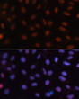 Anti-RB1 antibody (701-928) (STJ119248)