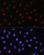 Immunofluorescence analysis of U-2 OS cells using RB Rabbit polyclonal antibody (STJ119248) at dilution of 1:100. Secondary antibody: Cy3 Goat Anti-Rabbit IgG (H+L) at 1:500 dilution. Blue: DAPI for nuclear staining.