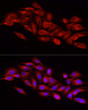 Immunofluorescence analysis of U2OS cells using DRP1 Rabbit polyclonal antibody (STJ119291) at dilution of 1:200 (40x lens). Blue: DAPI for nuclear staining.