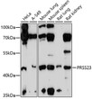 Western blot analysis of various lysates using PRSS23 Rabbit polyclonal antibody (STJ119306) at 1:1000 dilution. Secondary antibody: HRP Goat Anti-Rabbit IgG (H+L) (STJS000856) at 1:10000 dilution. Lysates/proteins: 25 Mu g per lane. Blocking buffer: 3% nonfat dry milk in TBST. Detection: ECL Enhanced Kit. Exposure time: 90s.