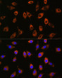 Immunofluorescence analysis of L929 cells using PPP1R9B Rabbit polyclonal antibody (STJ119355) at dilution of 1:100. Secondary antibody: Cy3 Goat Anti-Rabbit IgG (H+L) at 1:500 dilution. Blue: DAPI for nuclear staining.