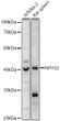 Western blot analysis of various lysates, using NPHS2 antibody (STJ119463) at 1:1000 dilution. Secondary antibody: HRP Goat Anti-Rabbit IgG (H+L) (STJS000856) at 1:10000 dilution. Lysates/proteins: 25 Mu g per lane. Blocking buffer: 3% nonfat dry milk in TBST. Detection: ECL Basic Kit. Exposure time: 20s.