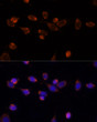 Immunofluorescence analysis of NIH/3T3 cells using PDHA1 Rabbit polyclonal antibody (STJ119549) at dilution of 1:100. Blue: DAPI for nuclear staining.
