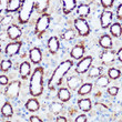 Immunohistochemistry analysis of PDHA1 in paraffin-embedded rat kidney using PDHA1 Rabbit polyclonal antibody (STJ119549) at dilution of 1:100 (40x lens). Perform microwave antigen retrieval with 10 mM Tris/EDTA buffer pH 9. 0 before commencing with immunohistochemistry staining protocol.