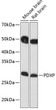 Western blot analysis of various lysates using PDXP Rabbit polyclonal antibody (STJ119571) at 1:1000 dilution. Secondary antibody: HRP Goat Anti-Rabbit IgG (H+L) (STJS000856) at 1:10000 dilution. Lysates/proteins: 25 Mu g per lane. Blocking buffer: 3% nonfat dry milk in TBST. Detection: ECL Basic Kit. Exposure time: 10s.