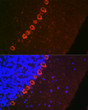 Immunofluorescence analysis of rat brain using Doublecortin rabbit polyclonal antibody (STJ119578) at dilution of 1:100 (40x lens). Blue: DAPI for nuclear staining.