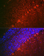 Immunofluorescence analysis of mouse brain using Doublecortin rabbit polyclonal antibody (STJ119578) at dilution of 1:100 (40x lens). Blue: DAPI for nuclear staining.