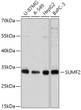 Western blot analysis of various lysates using SUMF2 Rabbit polyclonal antibody (STJ119720) at 1:1000 dilution. Secondary antibody: HRP Goat Anti-Rabbit IgG (H+L) (STJS000856) at 1:10000 dilution. Lysates/proteins: 25 Mu g per lane. Blocking buffer: 3% nonfat dry milk in TBST. Detection: ECL Basic Kit. Exposure time: 10s.