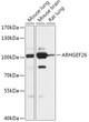 Western blot analysis of various lysates using ARHGEF26 Rabbit polyclonal antibody (STJ119725) at 1:1000 dilution. Secondary antibody: HRP Goat Anti-Rabbit IgG (H+L) (STJS000856) at 1:10000 dilution. Lysates/proteins: 25 Mu g per lane. Blocking buffer: 3% nonfat dry milk in TBST. Detection: ECL Basic Kit. Exposure time: 10s. Western blot analysis of various lysates using ARHGEF26 Rabbit polyclonal antibody (STJ119725) at 1:1000 dilution. Secondary antibody: HRP Goat Anti-Rabbit IgG (H+L) (STJS000856) at 1:10000 dilution. Lysates/proteins: 25 Mu g per lane. Blocking buffer: 3% nonfat dry milk in TBST. Detection: ECL Basic Kit. Exposure time: 10s.