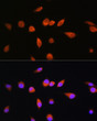 Immunofluorescence analysis of L929 cells using RAB20 Rabbit polyclonal antibody (STJ119767) at dilution of 1:100. Secondary antibody: Cy3 Goat Anti-Rabbit IgG (H+L) at 1:500 dilution. Blue: DAPI for nuclear staining.