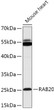 Western blot analysis of lysates from Mouse heart, using RAB20 Rabbit polyclonal antibody (STJ119767) at 1:1000 dilution. Secondary antibody: HRP Goat Anti-Rabbit IgG (H+L) (STJS000856) at 1:10000 dilution. Lysates/proteins: 25 Mu g per lane. Blocking buffer: 3% nonfat dry milk in TBST. Detection: ECL Basic Kit. Exposure time: 15s.