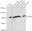 Western blot analysis of various lysates using UTP6 Rabbit polyclonal antibody (STJ119772) at 1:1000 dilution. Secondary antibody: HRP Goat Anti-Rabbit IgG (H+L) (STJS000856) at 1:10000 dilution. Lysates/proteins: 25 Mu g per lane. Blocking buffer: 3% nonfat dry milk in TBST. Detection: ECL Basic Kit. Exposure time: 5s.