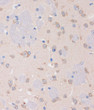 Immunohistochemistry analysis of STIM2 in paraffin-embedded Mouse brain using STIM2 Rabbit polyclonal antibody (STJ119784) at dilution of 1:100 (40x lens). Perform microwave antigen retrieval with 10 mM PBS buffer pH 7. 2 before commencing with immunohistochemistry staining protocol.