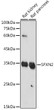 Western blot analysis of various lysates using SFXN2 Rabbit polyclonal antibody (STJ119842) at 1:1000 dilution. Secondary antibody: HRP Goat Anti-Rabbit IgG (H+L) (STJS000856) at 1:10000 dilution. Lysates/proteins: 25 Mu g per lane. Blocking buffer: 3% nonfat dry milk in TBST. Detection: ECL Basic Kit. Exposure time: 30s.