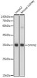 Western blot analysis of various lysates using SFXN2 Rabbit polyclonal antibody (STJ119842) at 1:1000 dilution. Secondary antibody: HRP Goat Anti-Rabbit IgG (H+L) (STJS000856) at 1:10000 dilution. Lysates/proteins: 25 Mu g per lane. Blocking buffer: 3% nonfat dry milk in TBST. Detection: ECL Basic Kit. Exposure time: 1s.