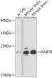 Western blot analysis of various lysates using RAB7B Rabbit pAb (STJ119868) at 1:1000 dilution. <br/>Secondary antibody: HRP-conjugated Goat anti-Rabbit IgG (H+L) (STJS000856) at 1:10000 dilution. <br/>Lysates/proteins: 25 Mu g per lane. <br/>Blocking buffer: 3% nonfat dry milk in TBST. <br/>Detection: ECL Basic Kit <br/>Exposure time: 3s.