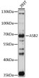 Western blot analysis of lysates from 293T cells, using ASB2 Rabbit polyclonal antibody (STJ119909) at 1:1000 dilution. Secondary antibody: HRP Goat Anti-Rabbit IgG (H+L) (STJS000856) at 1:10000 dilution. Lysates/proteins: 25 Mu g per lane. Blocking buffer: 3% nonfat dry milk in TBST. Detection: ECL Basic Kit. Exposure time: 180s.