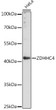 Western blot analysis of lysates from HeLa cells, using ZDHHC4 Rabbit polyclonal antibody (STJ119958) at 1:1000 dilution. Secondary antibody: HRP Goat Anti-Rabbit IgG (H+L) (STJS000856) at 1:10000 dilution. Lysates/proteins: 25 Mu g per lane. Blocking buffer: 3% nonfat dry milk in TBST. Detection: ECL Basic Kit. Exposure time: 60s.