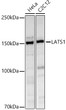 Western blot analysis of extracts of various cell lines, using LATS1 antibody (STJ119966) at 1:1000 dilution. Secondary antibody: HRP Goat Anti-Rabbit IgG (H+L) (STJS000856) at 1:10000 dilution. Lysates/proteins: 25 Mu g per lane. Blocking buffer: 3% nonfat dry milk in TBST. Detection: ECL Basic Kit. Exposure time: 10s.