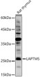 Western blot analysis of extracts of Rat thymus, using LAPTM5 antibody (STJ119968) at 1:1000 dilution. Secondary antibody: HRP Goat Anti-Rabbit IgG (H+L) (STJS000856) at 1:10000 dilution. Lysates/proteins: 25 Mu g per lane. Blocking buffer: 3% nonfat dry milk in TBST. Detection: ECL Basic Kit. Exposure time: 60s.