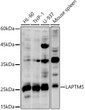 Western blot analysis of extracts of various cell lines, using LAPTM5 antibody (STJ119968) at 1:1000 dilution. Secondary antibody: HRP Goat Anti-Rabbit IgG (H+L) (STJS000856) at 1:10000 dilution. Lysates/proteins: 25 Mu g per lane. Blocking buffer: 3% nonfat dry milk in TBST. Detection: ECL Basic Kit. Exposure time: 30s.