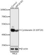 Western blot analysis of lysates from wild type (WT) and Cytokeratin 20 (Cytokeratin 20 (KRT20) ) knockout (KO) HeLa cells, using [KO Validated] Cytokeratin 20 (KRT20) Rabbit polyclonal antibody (STJ119970) at 1:1000 dilution. Secondary antibody: HRP Goat Anti-Rabbit IgG (H+L) (STJS000856) at 1:10000 dilution. Lysates/proteins: 25 Mu g per lane. Blocking buffer: 3% nonfat dry milk in TBST. Detection: ECL Basic Kit. Exposure time: 1s.