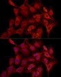 Immunofluorescence analysis of C6 cells using MCL1 rabbit polyclonal antibody (STJ119974) at dilution of 1:100 (40x lens). Blue: DAPI for nuclear staining.